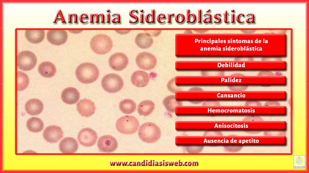 tipos-de-anemia-anemia-siderobl-stica