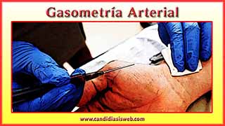 Gasometría Arterial