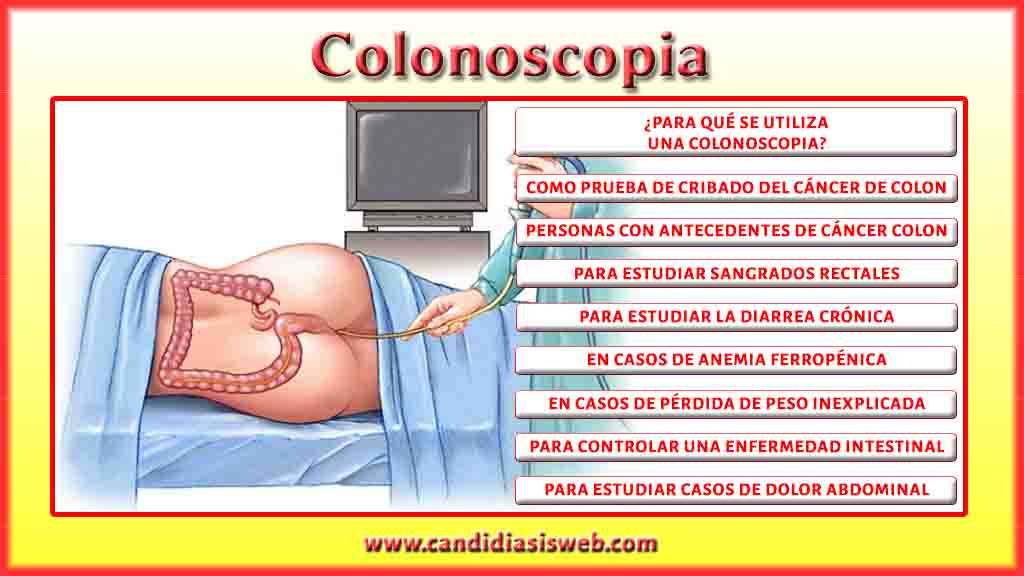 Pruebas y Examenes Colonoscopia