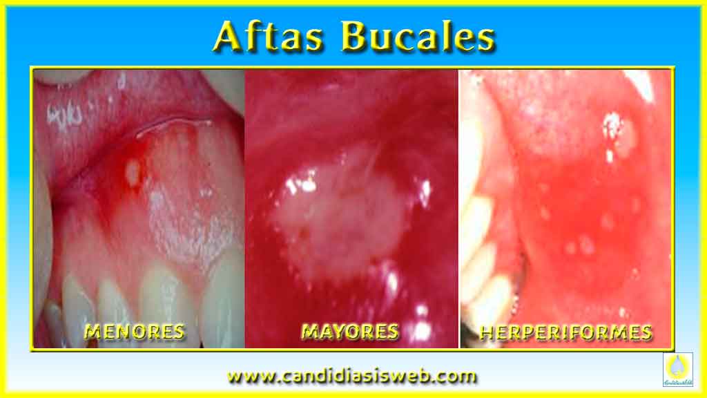 ShemehtyuahtyuiPrince