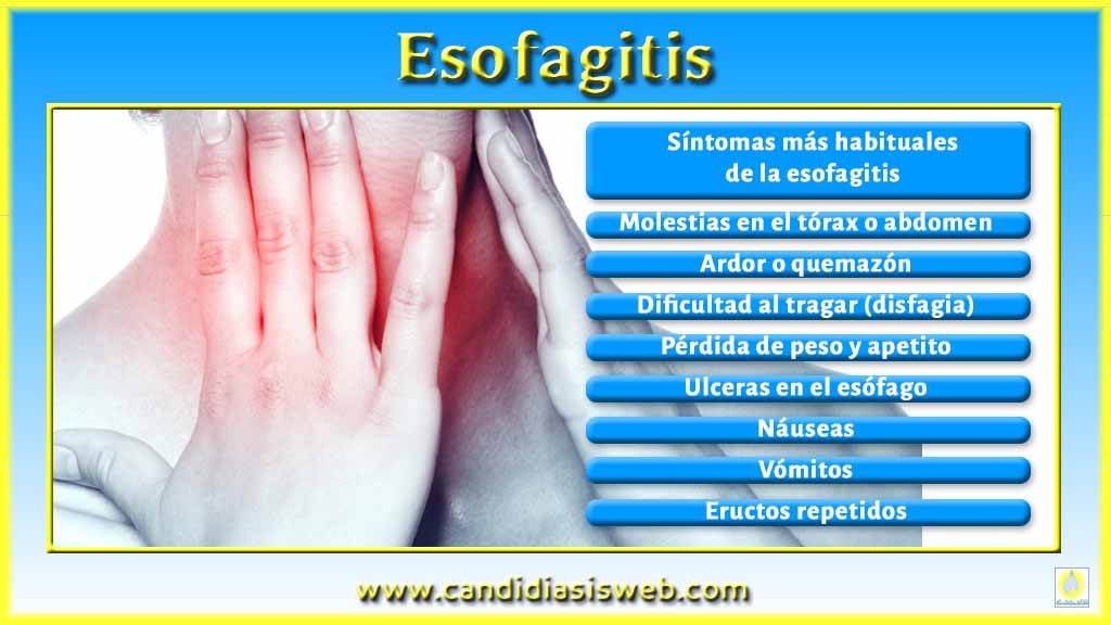 Vsd en el fondo sheynogo de la osteocondrosis los síntomas