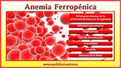 Anemia Ferropénica