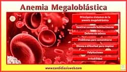 Anemia Megaloblástica
