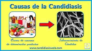 Causas de la candidiasis