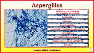 Aspergillus