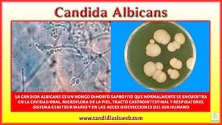 Candida Albicans
