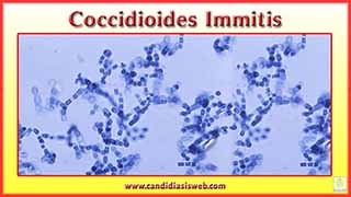 Coccidioides immitis