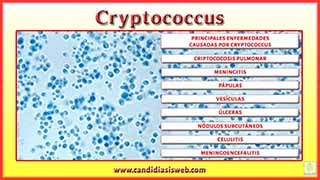 Cryptococcus