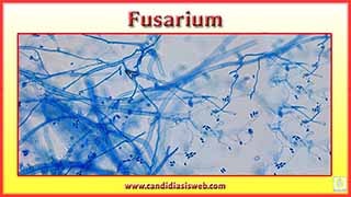 Fusarium