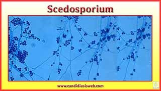 Scedosporium