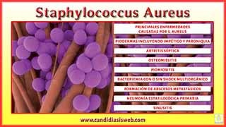 Staphylococcus Aureus