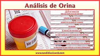 Análisis de orina