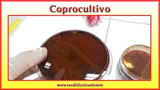 Coprocultivo