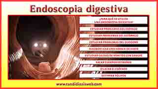 Endoscopia Digestiva