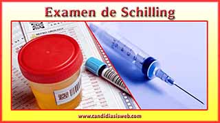 Examen de Schilling