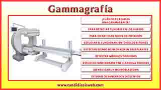 Gammagrafía
