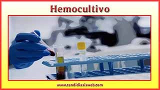 Hemocultivo