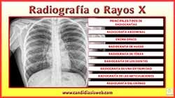 Radiografía o Rayos X