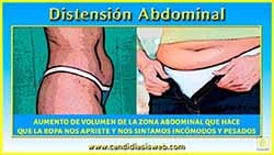 Distensión Abdominal