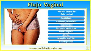 Flujo Vaginal