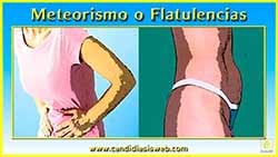 Meteorismo o Flatulencia