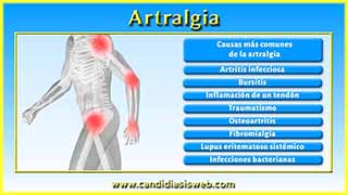 Artralgia