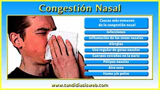 Congestión Nasal
