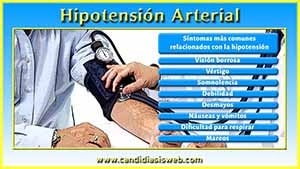 Hipotensión Arterial
