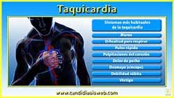 Taquicardia