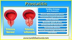 Prostatitis