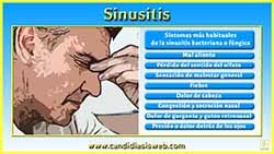 Sinusitis
