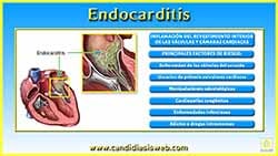 Endocarditis Candidiásica
