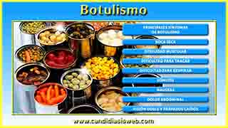 Botulismo