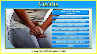 Cistitis