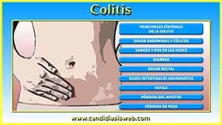 Colitis