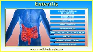 Enteritis