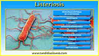 Listeriosis