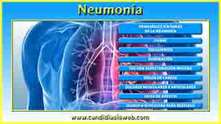 Neumonía