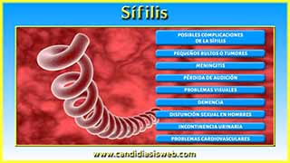Sífilis
