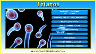 Tétanos