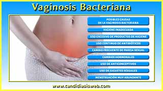 Vaginosis Bacteriana