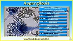 Aspergilosis