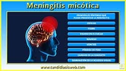 Meningitis Micótica
