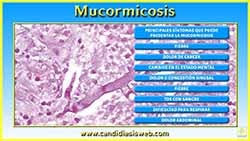 Mucormicosis